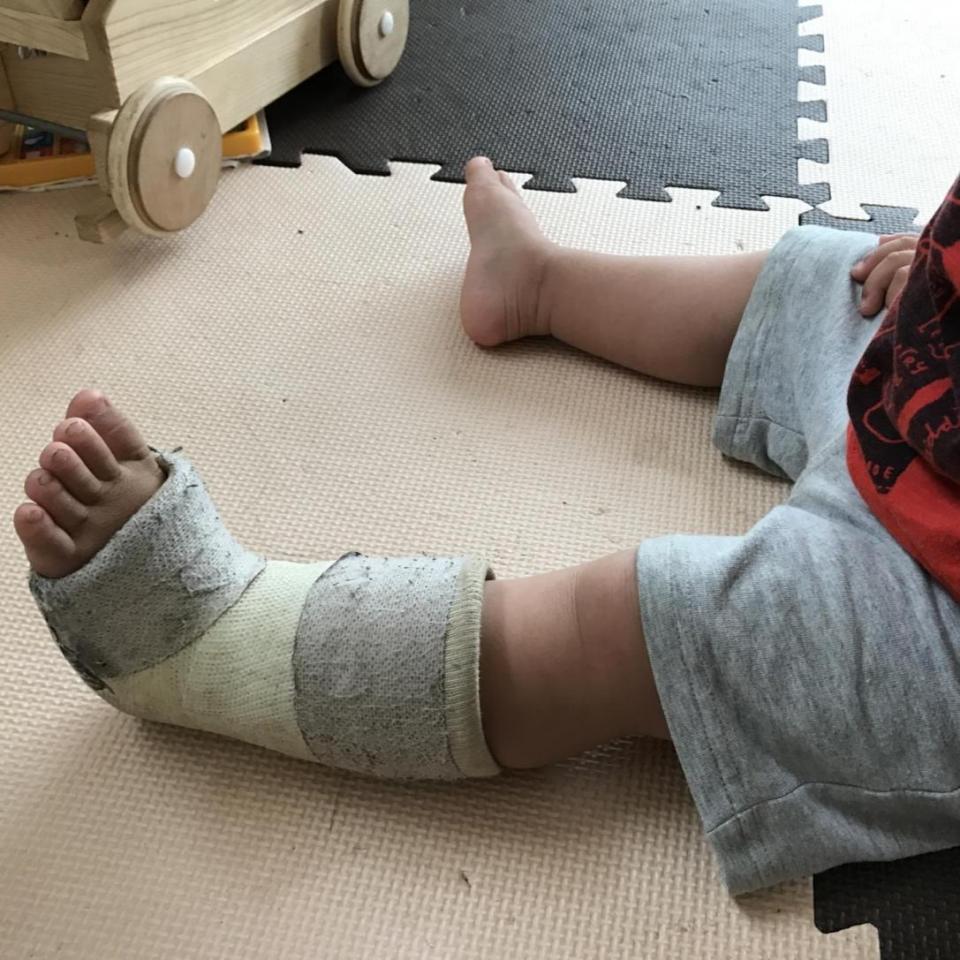 保育実習・教育実習中の困りごとへの対処法！目の前で子どもがケガをした時はどうしたらいいの？